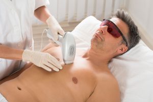 Nonsurgical hair removal in Sacramento