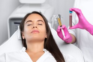 PRP skin treatment sacramento